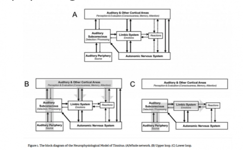 Neurophysiological model of tinnitus